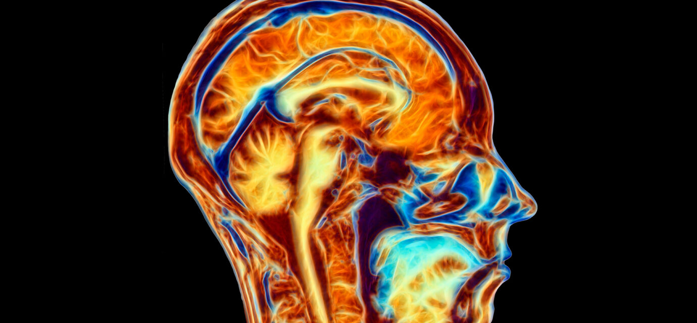 Diagram Of A Patriot’s Brain