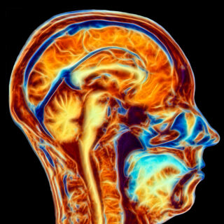 Diagram Of A Patriot’s Brain