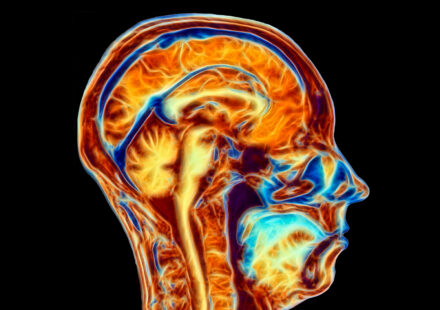 Diagram Of A Patriot’s Brain