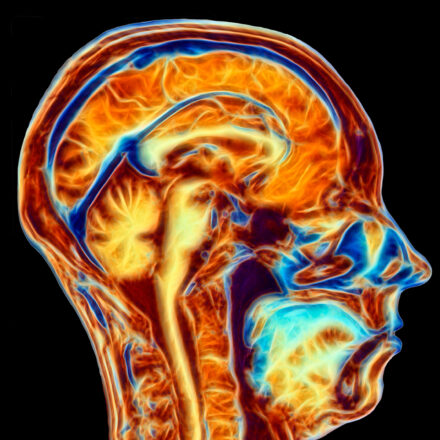 Diagram Of A Patriot’s Brain